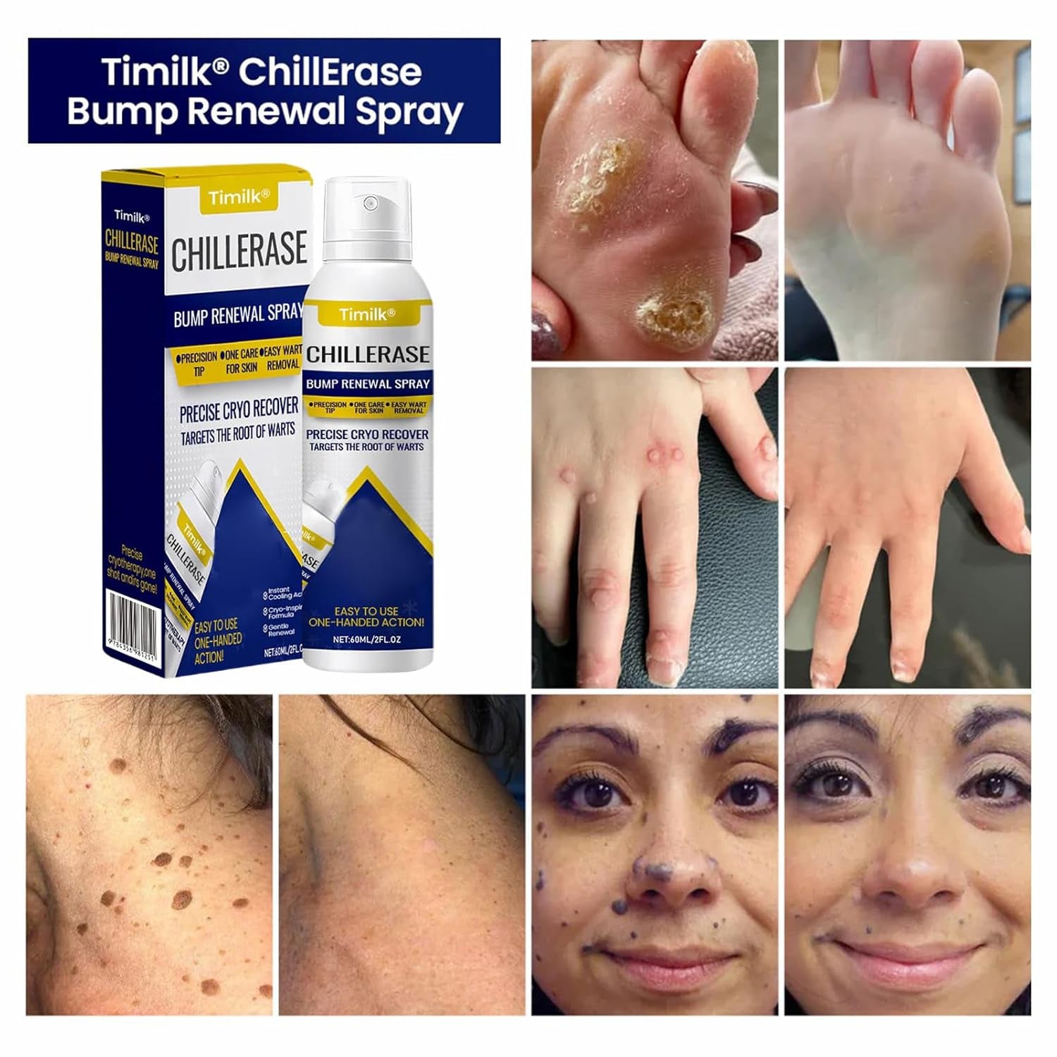 Cooling Bump Renewal Spray