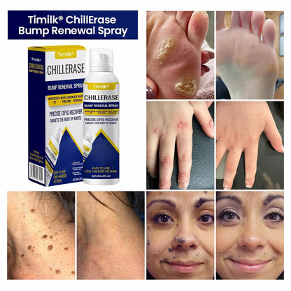 Cooling Bump Renewal Spray